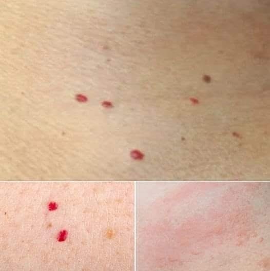 Red dots on your skin: Causes and