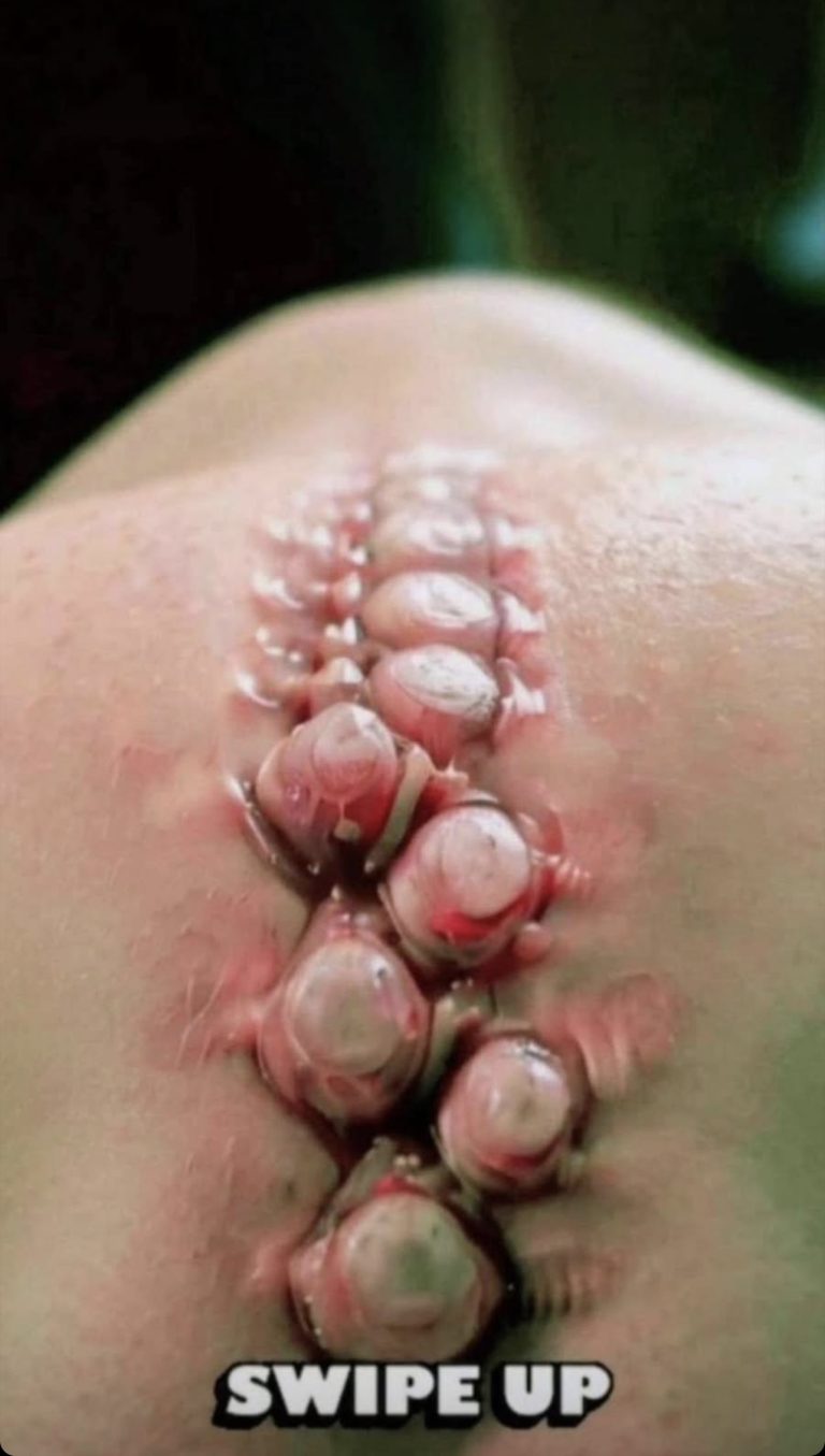 Seven (7) Things That Clog Your Pores