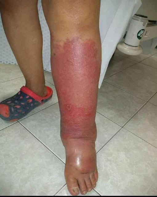 Signs on your FEET that indicate he is cr…