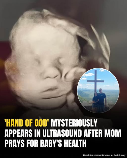 Mom spots ‘God’s hand’ cradling baby’s head i