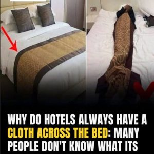 What’s The Purpose Of The Fabric Strip