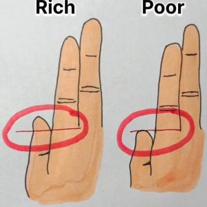 Your Fingers Could Reveal Whether You’re Rich or Poor