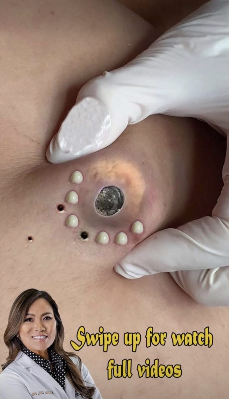 Causes that clog your pores…