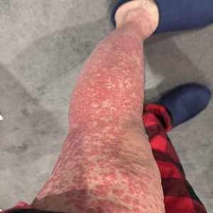 These are the consequences of…