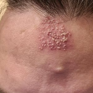 These are the consequences of sleeping…