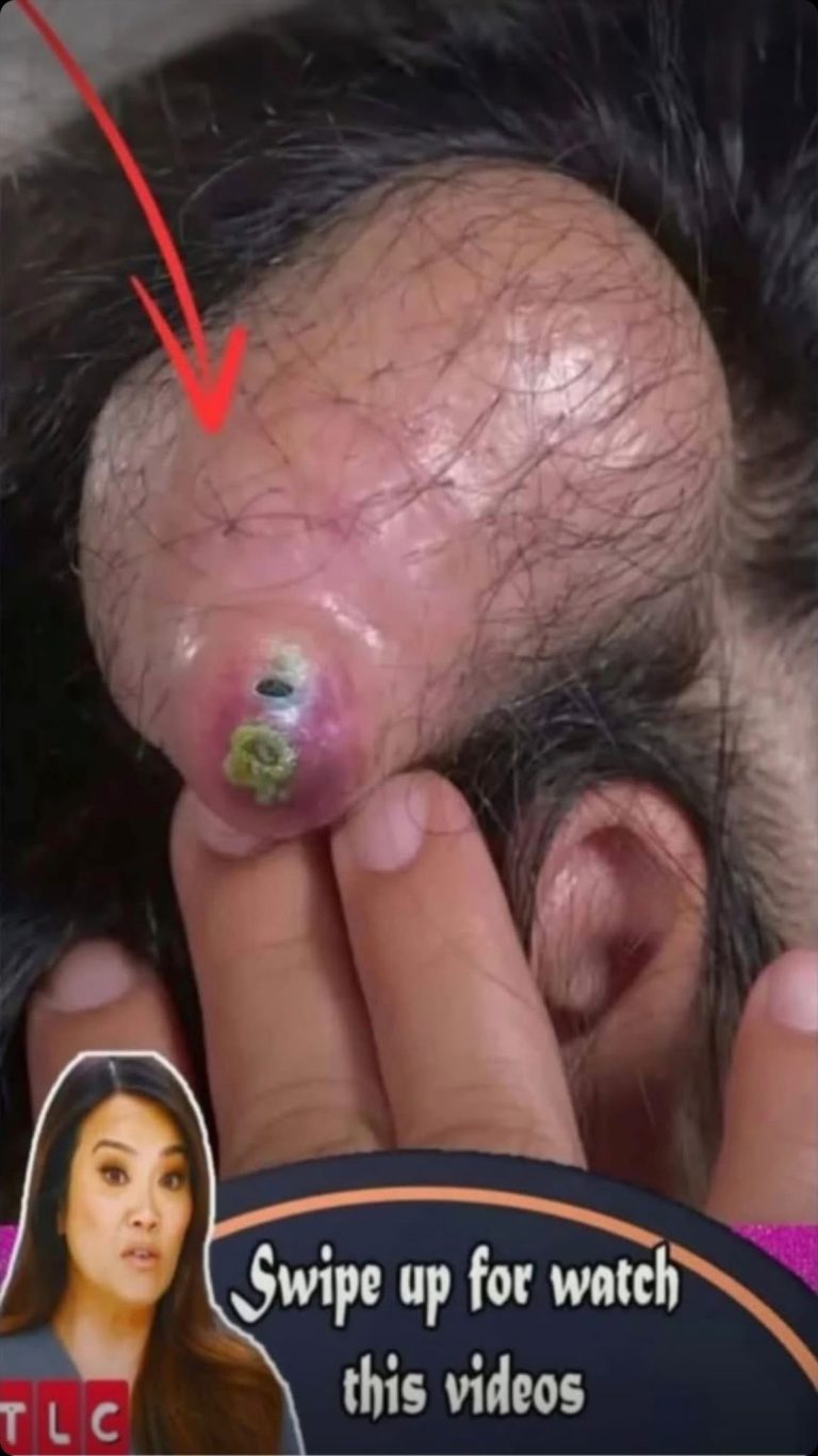 Tracking the Healing Journey of a