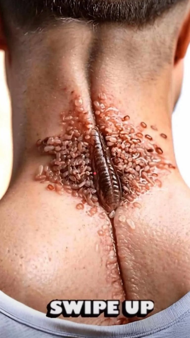 Changes in the Face That Indicate Serious