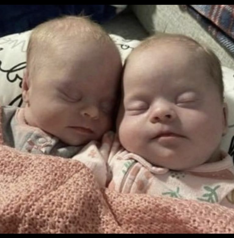 Mom of rare twins with Down syndrome shuts