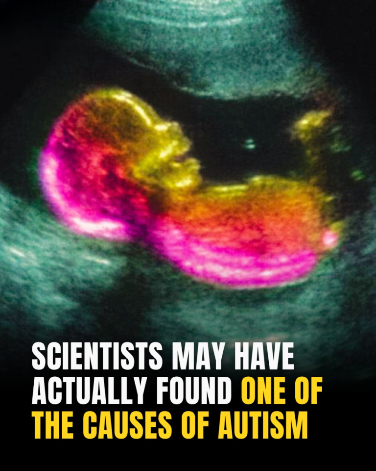 Study Suggests Key Link That Could Help Explain Autism