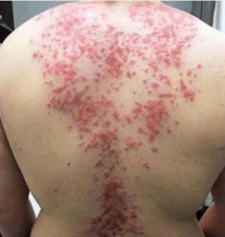 These are the consequences of sleeping with the