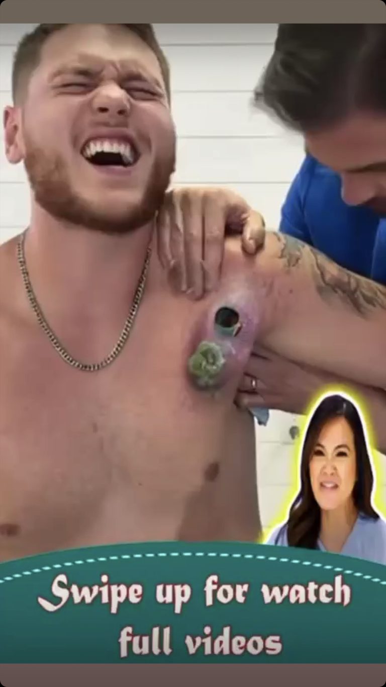 3 – Simple Ways To Recognize Possible Body