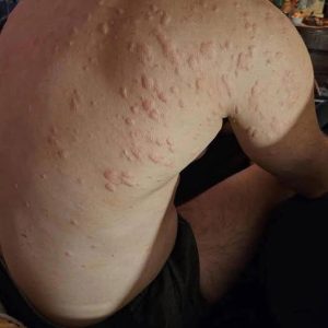 Unexpected Consequences of Sleeping with the