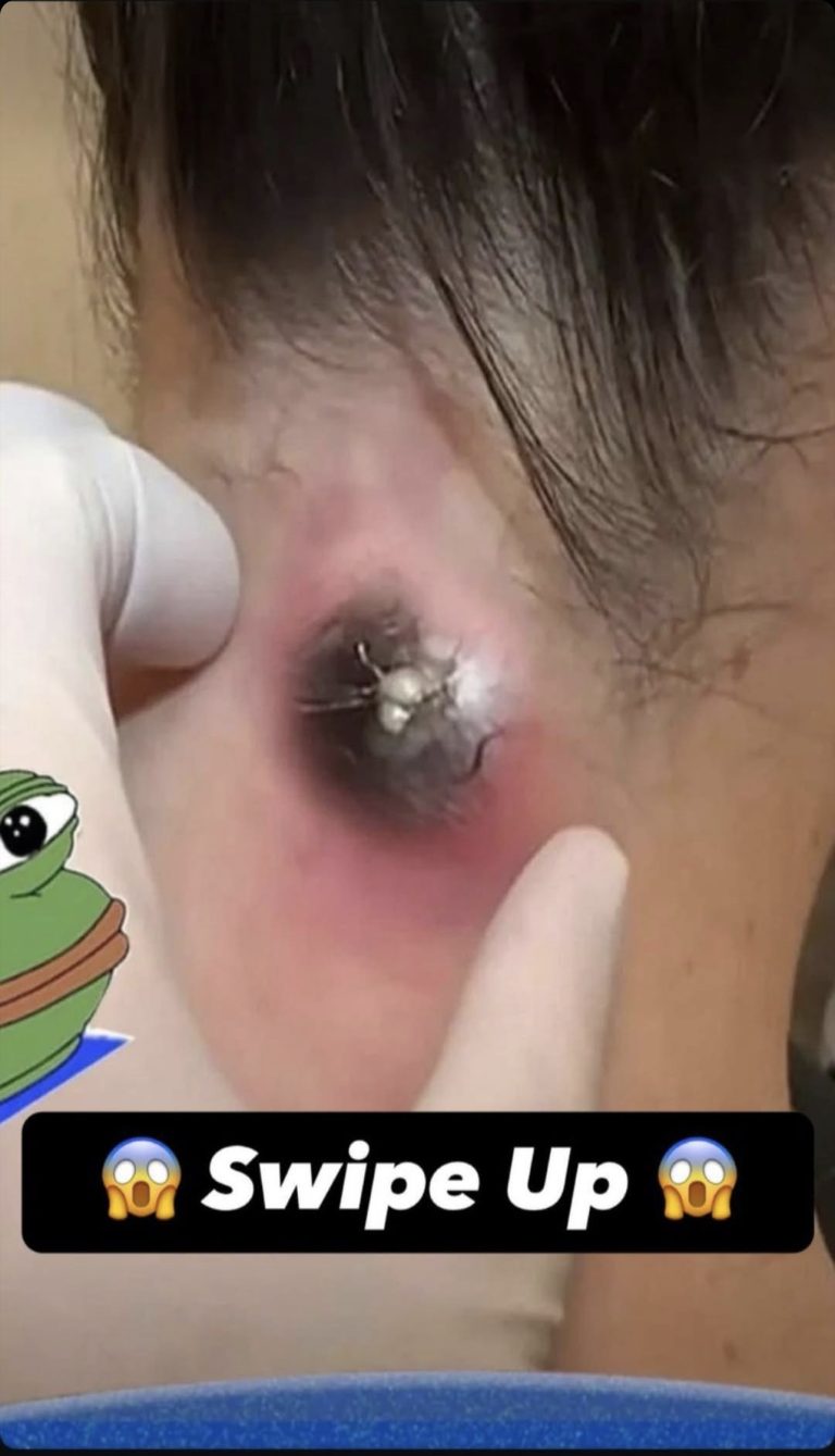 What Can Happen to Your Body If