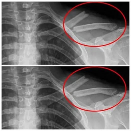 This drink destroys your bones but