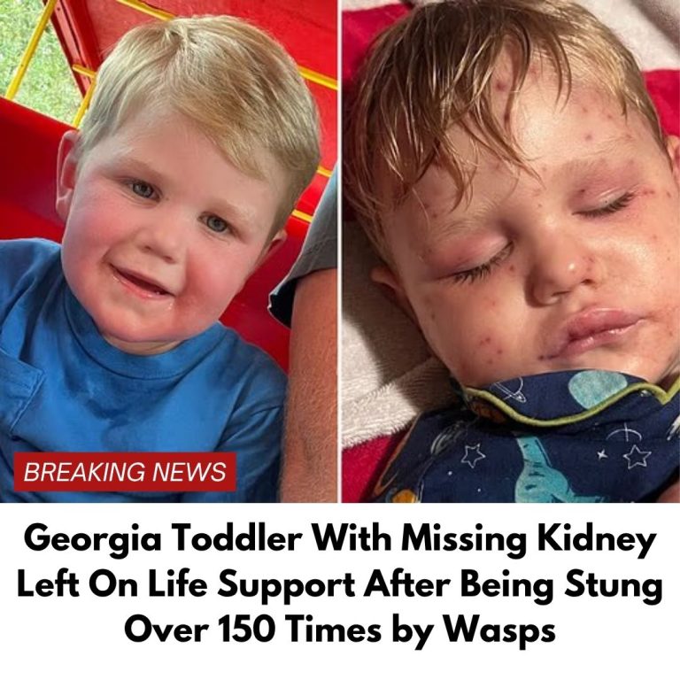 Georgia toddler stung over 150 times by yellow jackets,