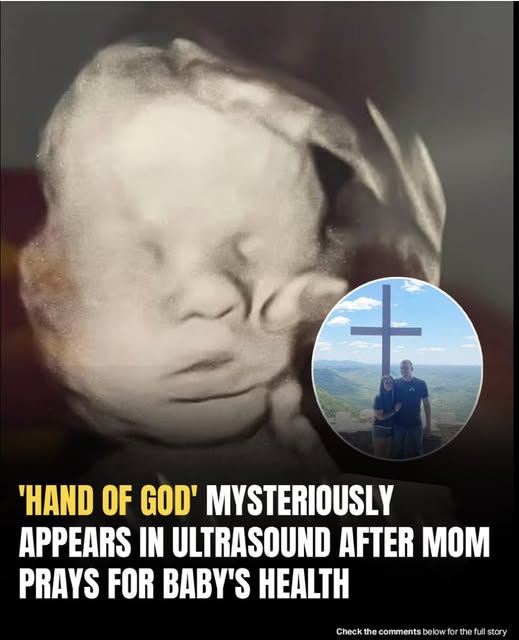 Mom spots ‘God’s hand’ cradling baby’s head
