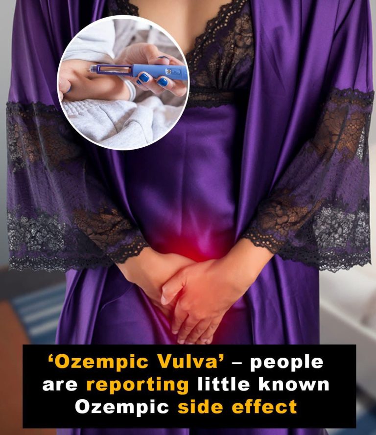 Women share Ozempic side effect known as ‘ozempic vulva’