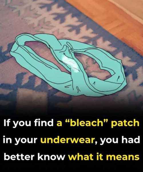 When “Bleach” Patches in Your Underwear Signal