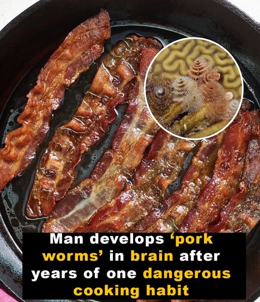 Man develops ‘pork worms’ after years of one