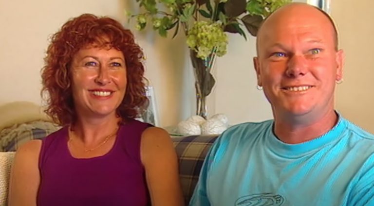 In 1993, This Boy Was Born With Enough Skin For A Five-Year-Old