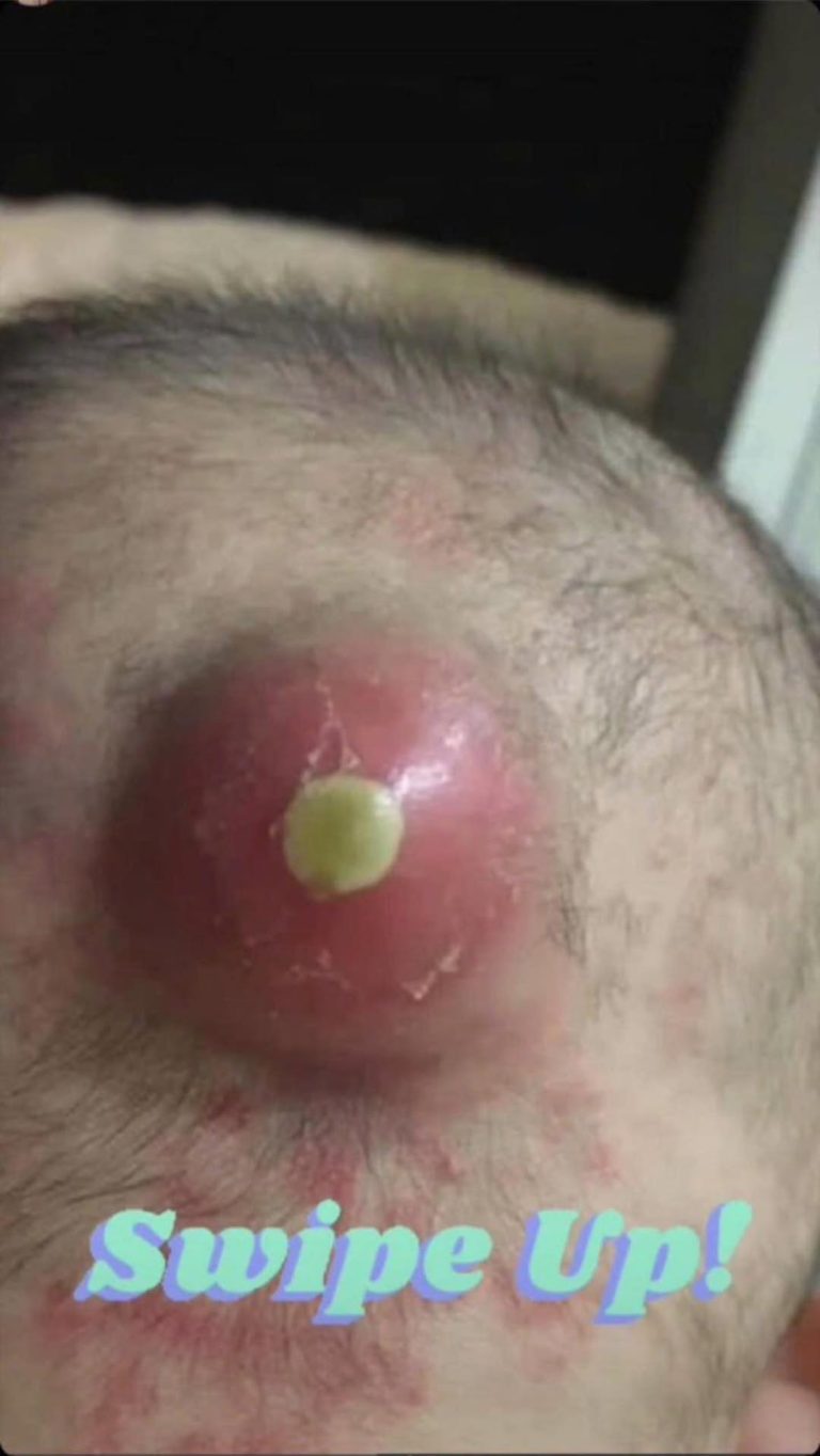 8 ALARMING SKIN SIGNS YOU CAN’T I