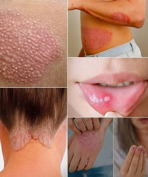 Signs you should know if you have th