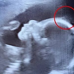 Doctors couldn’t believe what they