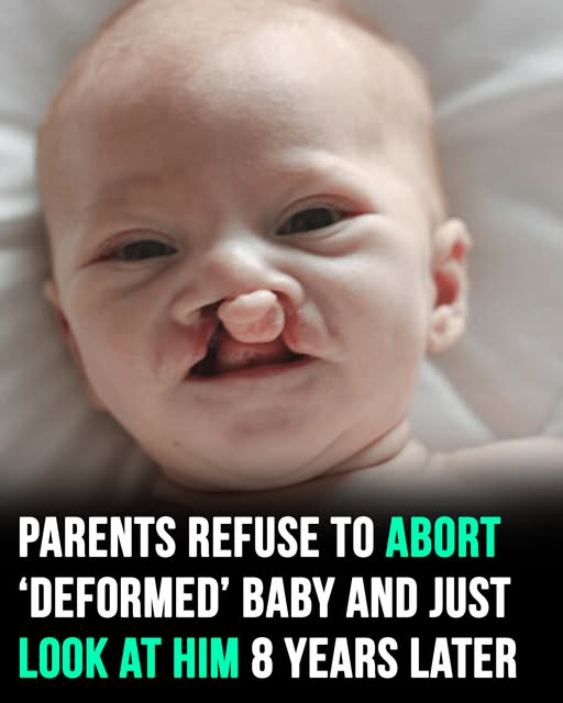 Parents refuse to abort deformed baby