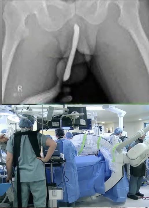 A young girl was hospitalized after attempting