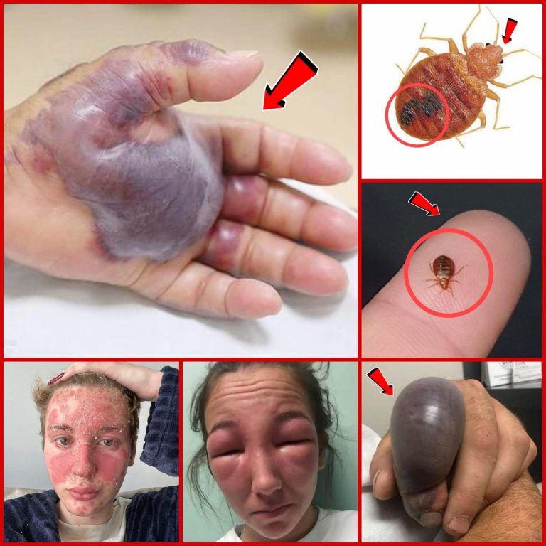 ATTENTION to these first signs of