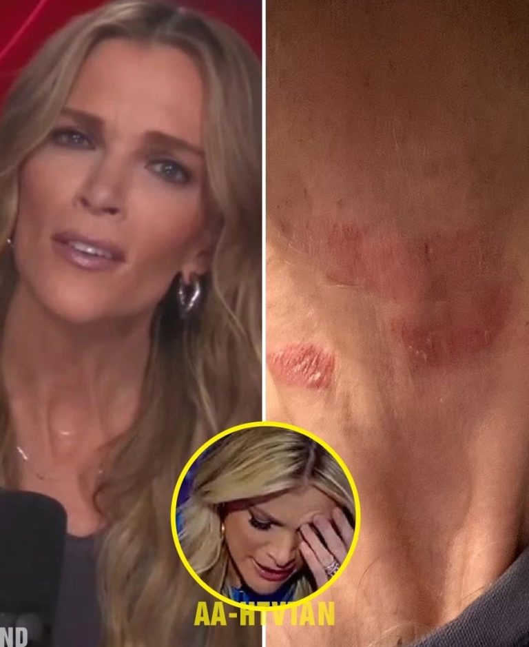 Megyn Kelly Hospitalized in Critical