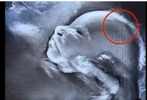 Doctors couldn’t believe