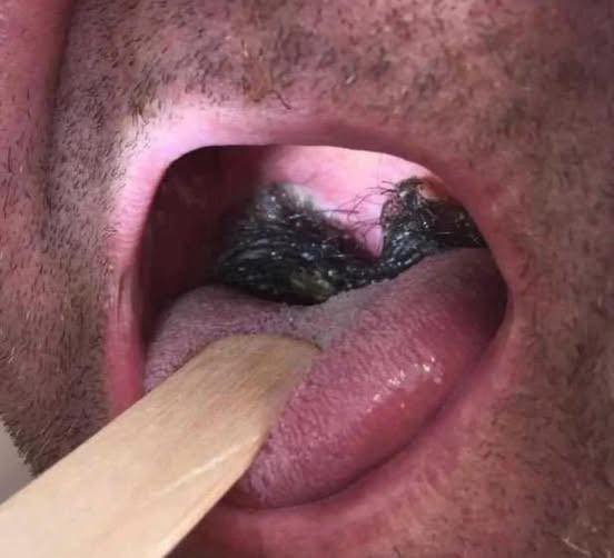 What No One Tells You About Intim