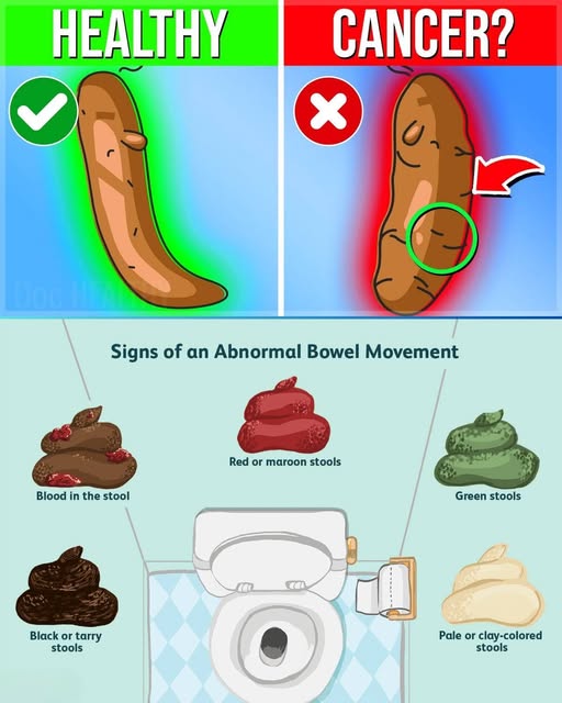 What Your Stool Color Reveals About Your Health