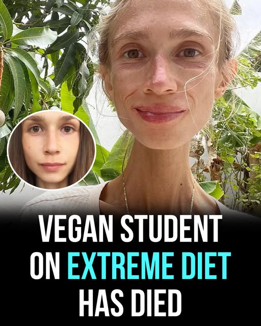 Woman, 27, starved to death in hotel