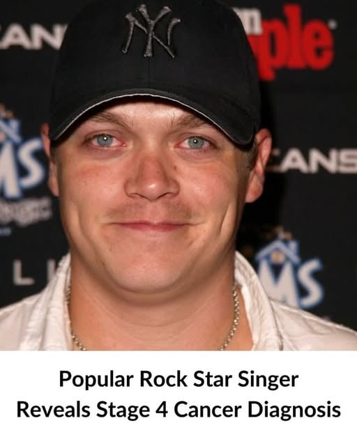 Popular Rock Band Singer Reveals Stage