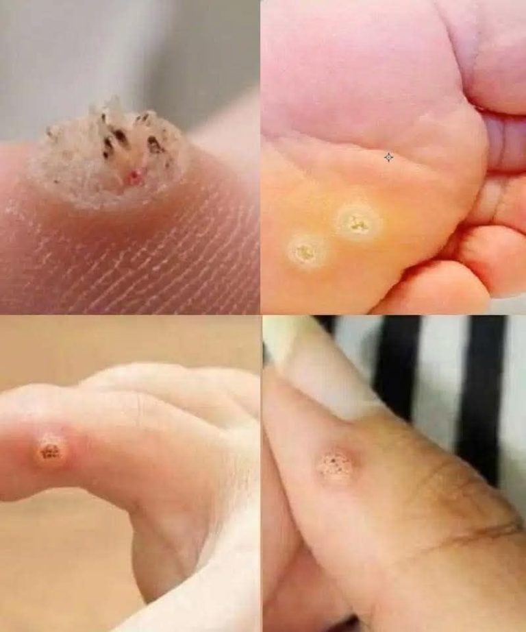 BE VERY CAREFUL . If you get this