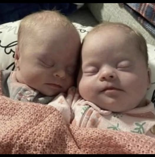 Mom of twins with Down syndrome