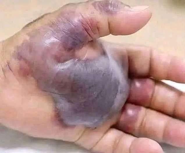 ATTENTION to these first si