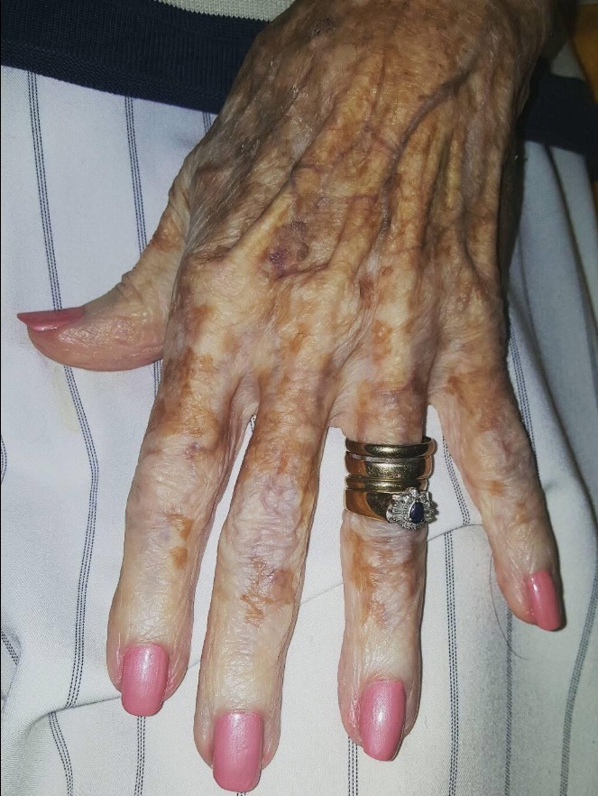 Nurse takes photo of old lady’s hand