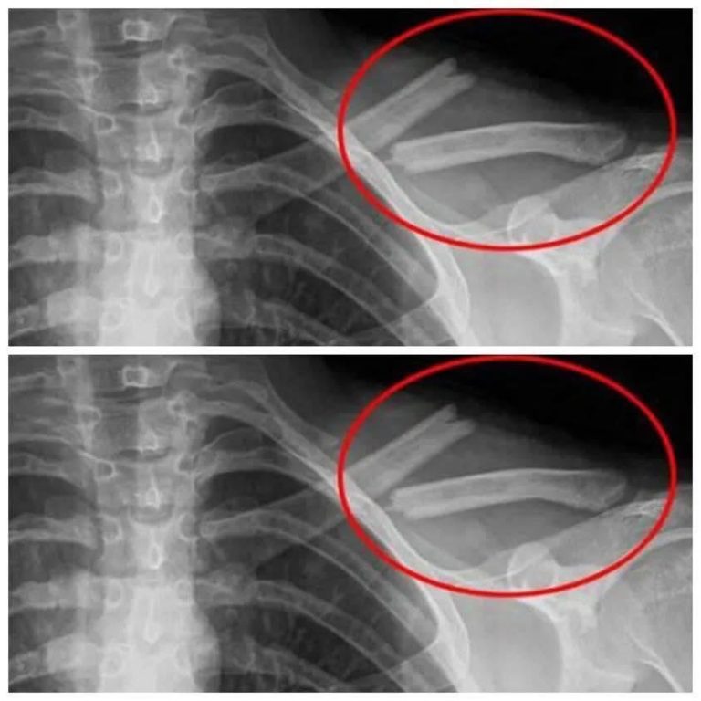 This Drink WiII Destroy Your Bones