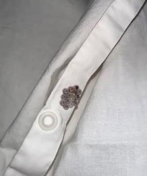 I found these tiny balls in my bed