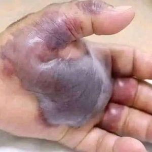 ATTENTION to these first signs of…