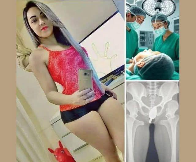 Girl had to be hospitalized for wanting to u