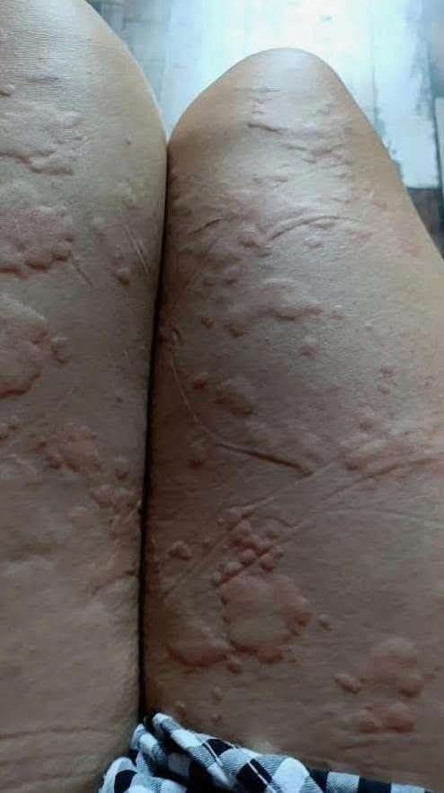 HT! These are the consequences of sleeping