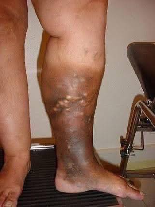 These are the first symptoms of a