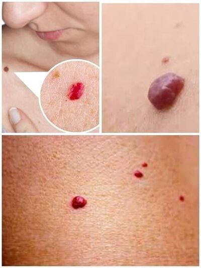 If you notice small red dots on your skin,