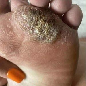 BE VERY CAREFUL . If you get this, you are infected with ….