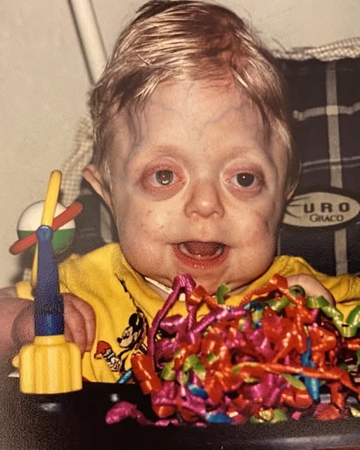 Defied Every Doctor’s Prediction