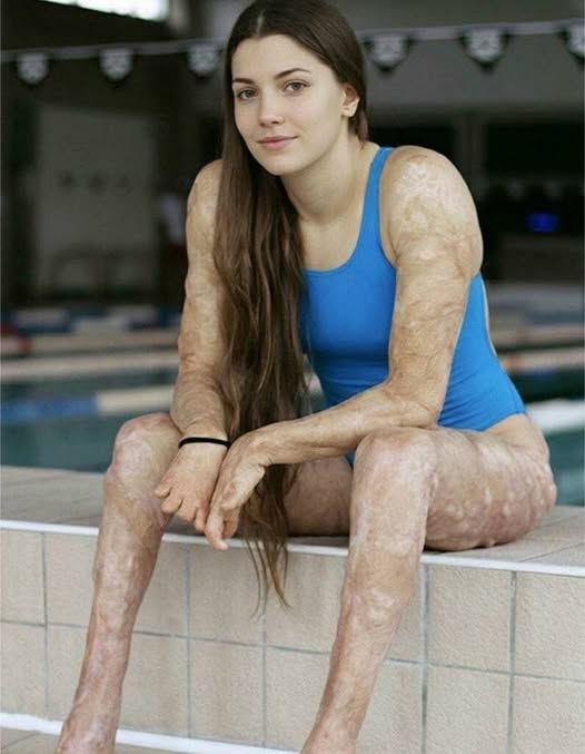 These are the consequences of sleeping with the